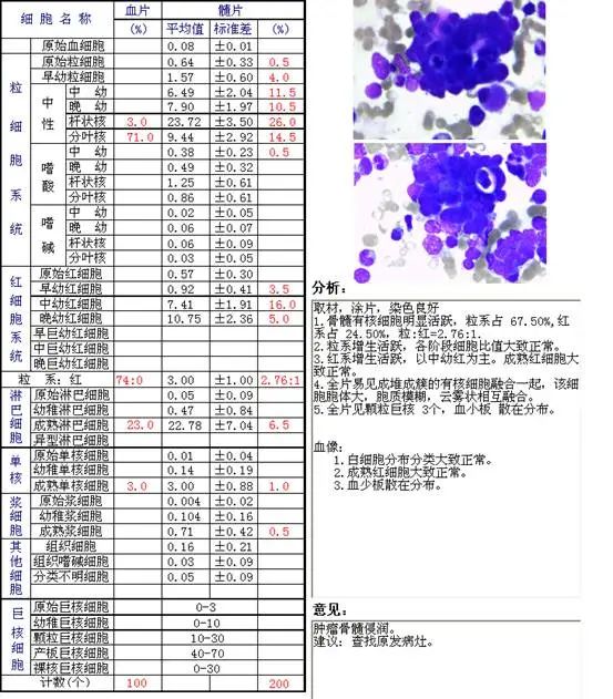 aspirate_aspirate词根_aspirateur