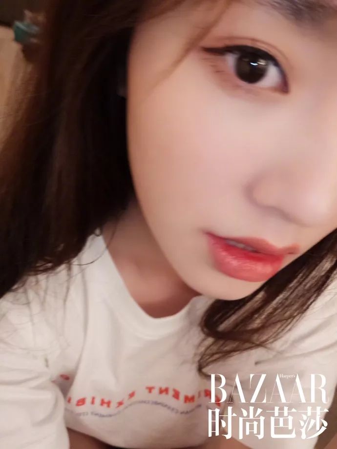 唇枪_唇_玻尿酸鼻唇沟丰唇经历