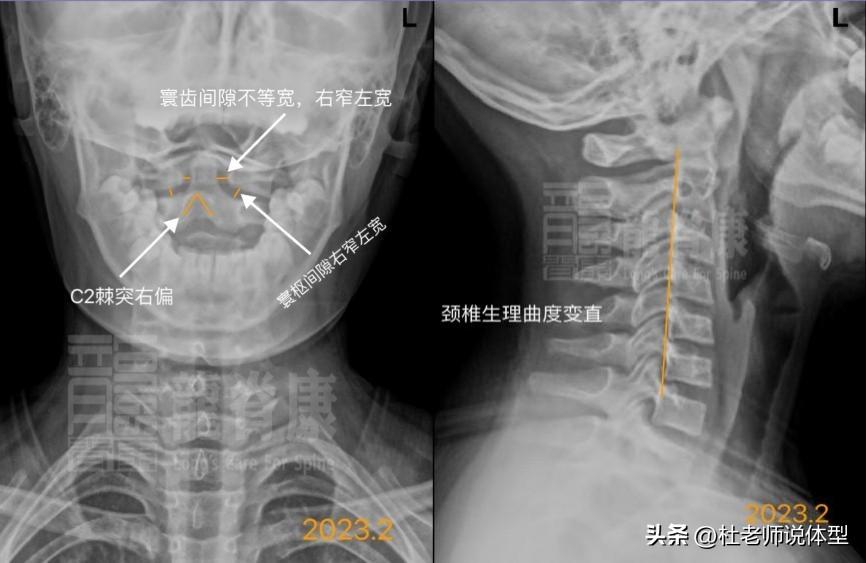 耸怎么读_耸的组词_耸