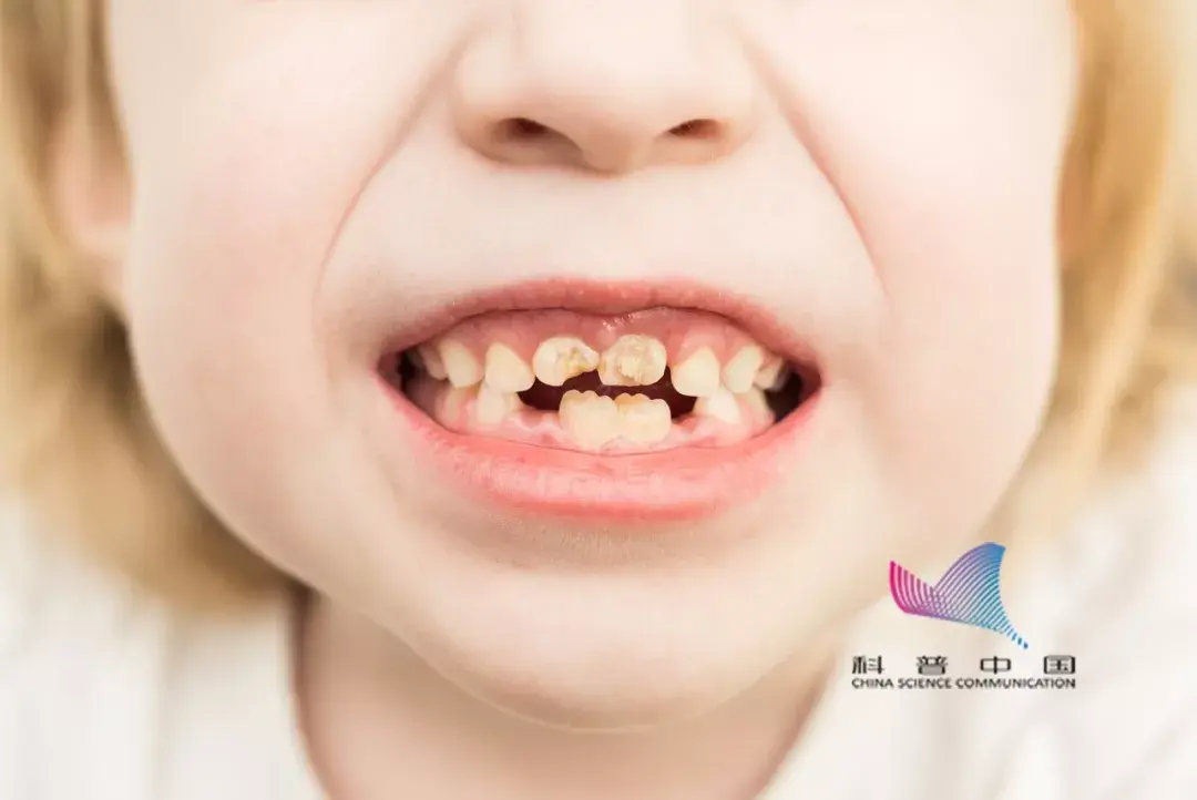 臭鳜鱼_肛门臭不是屎臭_臭