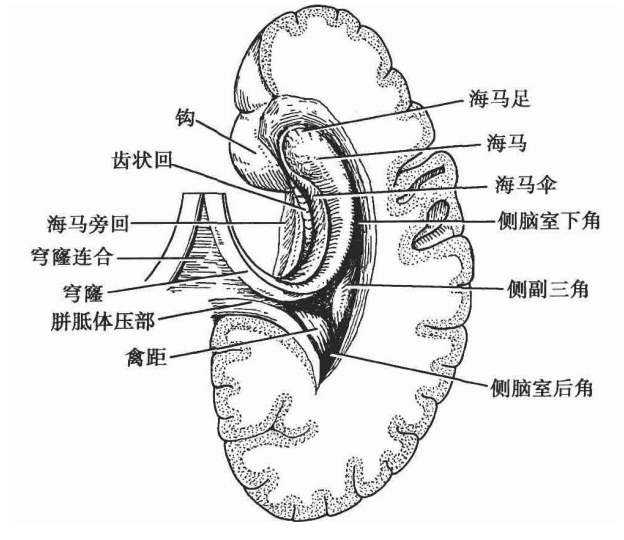 fissure翻译_fissure是什么意思_fissure