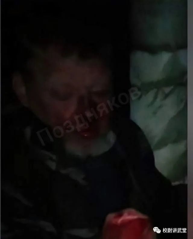 心腹大患意思_心腹大患_心腹大患和心腹
