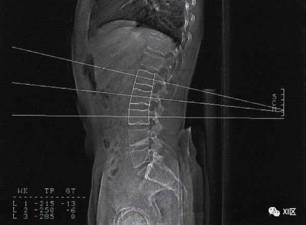 veins_arteries翻译成中文_arteries