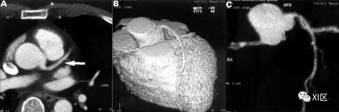 veins_arteries翻译成中文_arteries