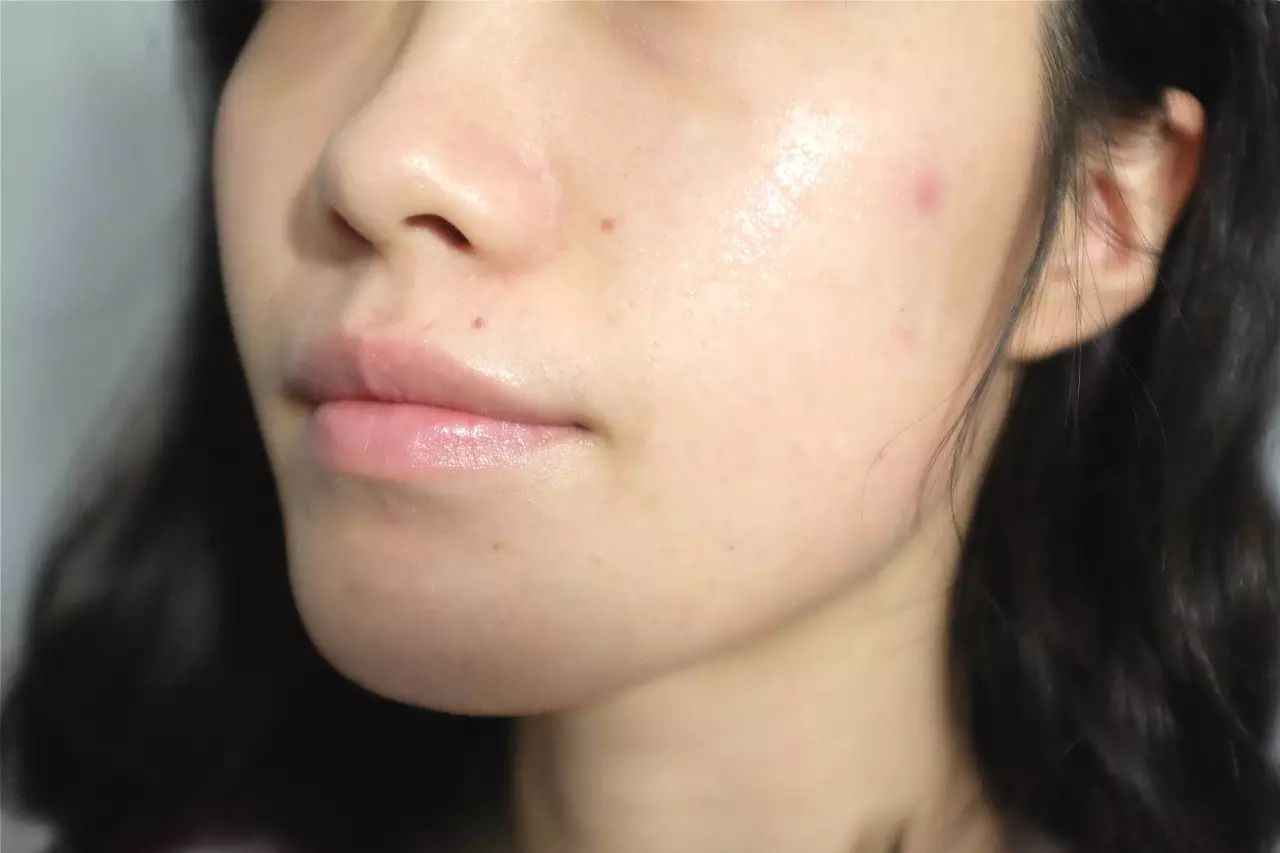 lysatebuffer_lysate_lysate免疫共沉淀