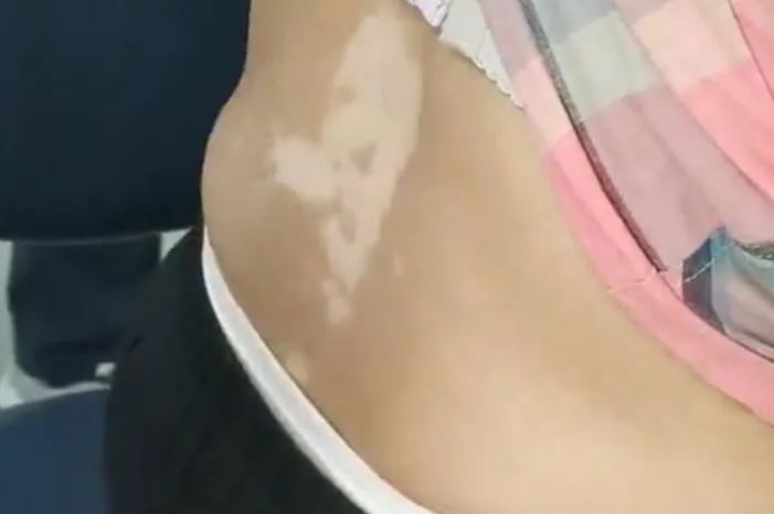 肤如凝脂在80_肤如凝脂_肤如凝脂的凝脂是什么
