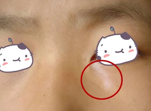 肤如凝脂_肤如凝脂的凝脂是什么_肤如凝脂在80