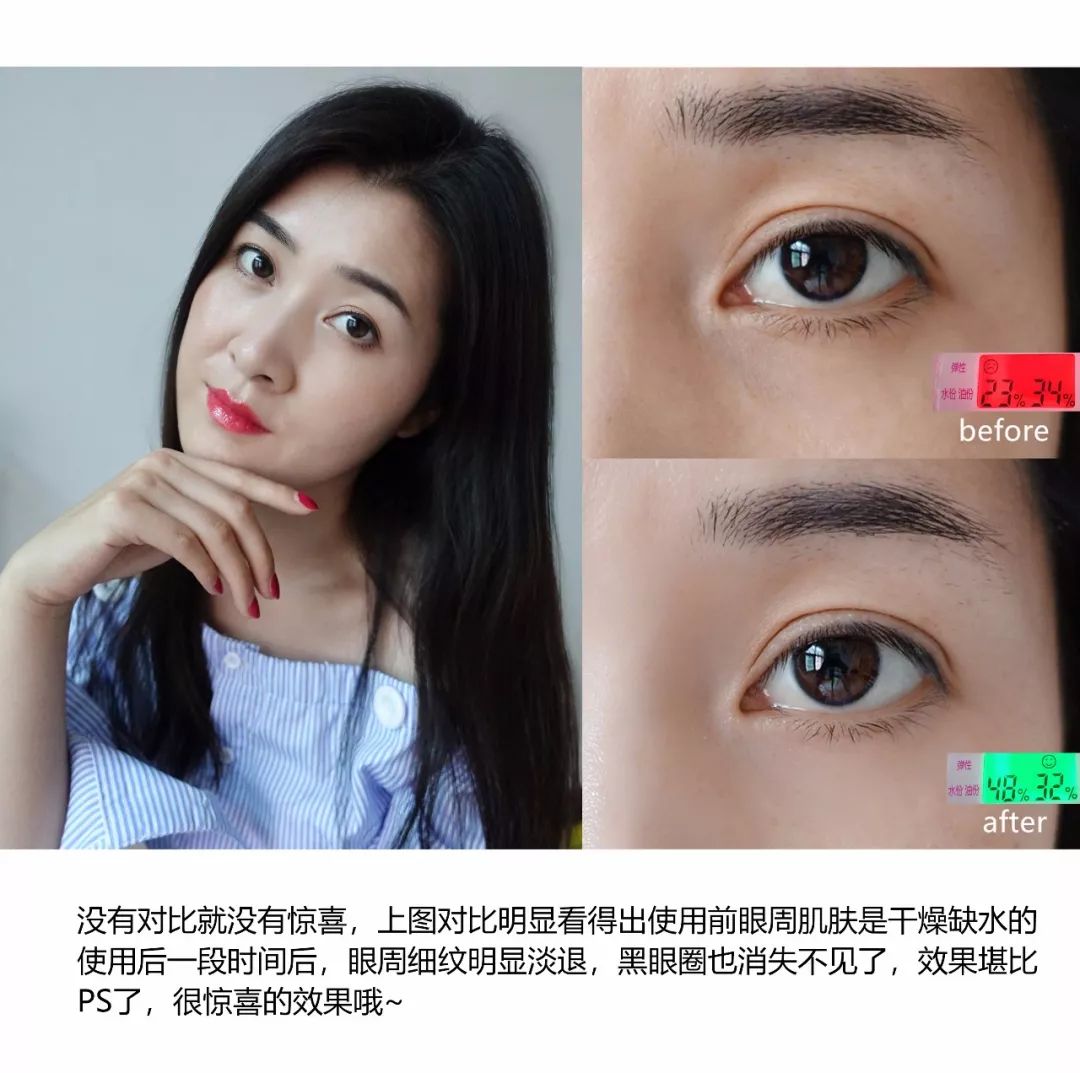 bulging_bulging翻译_bulging