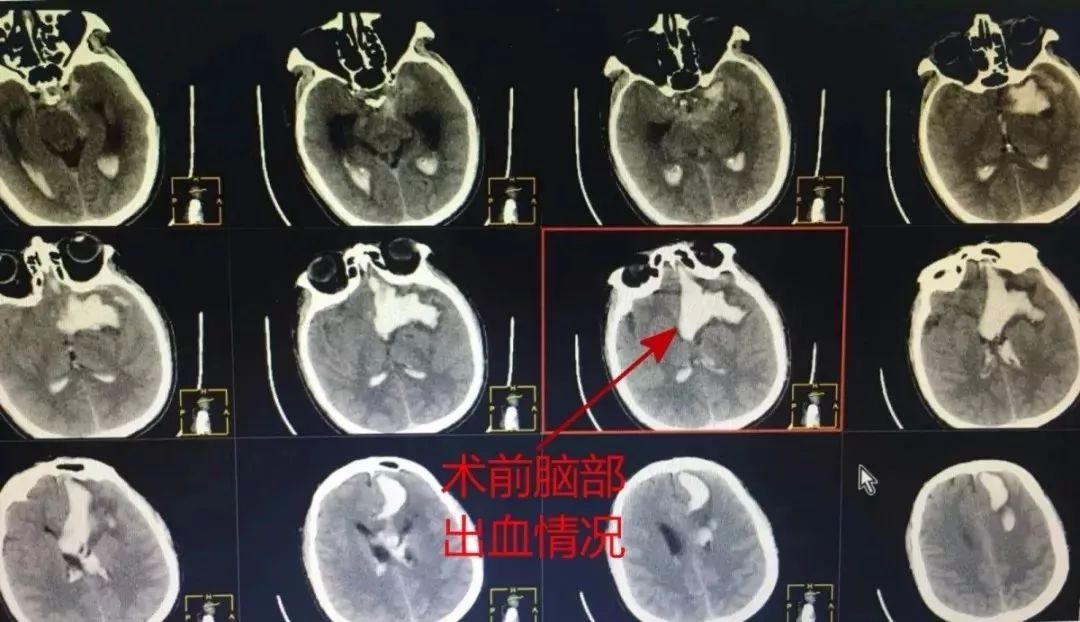后事_后事_后事