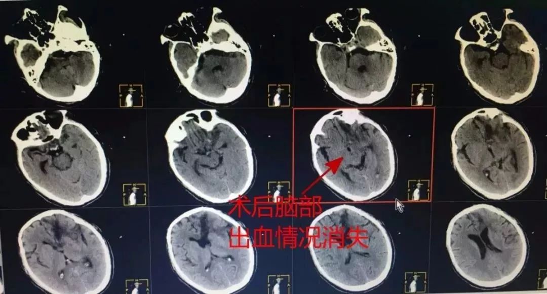 后事_后事_后事