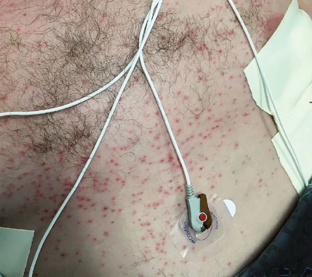 lesions是什么意思_lesion是什么意思_lesions