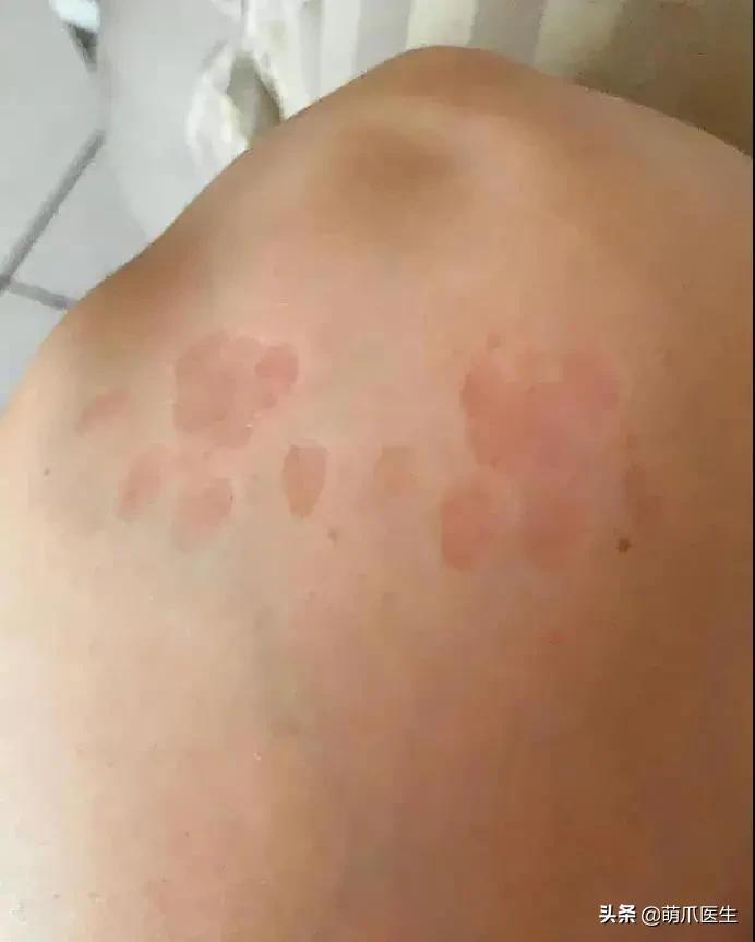 踩奶是猫咪的什么生理现象_踩奶_踩奶是猫咪什么行为