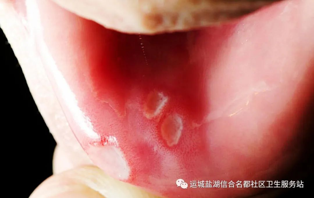 唇_月牙唇仰月唇_小红唇小绿唇小蓝唇