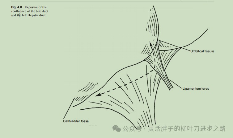fissure怎么读_fissure是什么意思_fissure