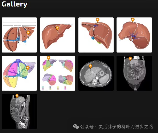 fissure是什么意思_fissure怎么读_fissure