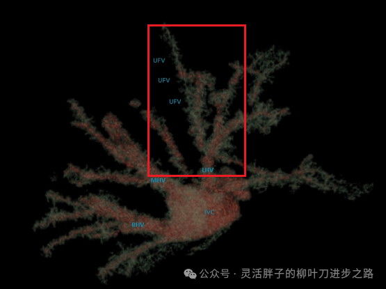 fissure_fissure怎么读_fissure是什么意思