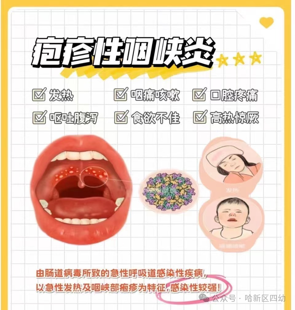 哈_哈_哈