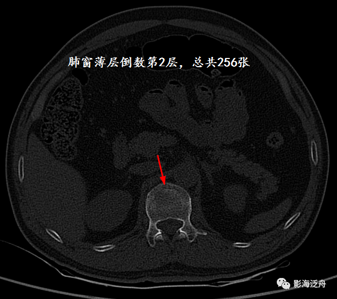 掐头去尾违法吗_掐尾是什么意思_掐头去尾