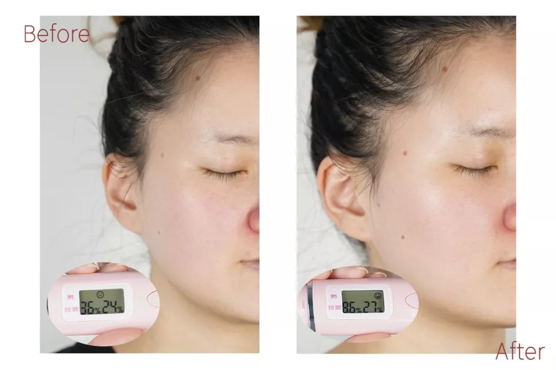 子宫肌瘤是什么原因导致的_子都_子时