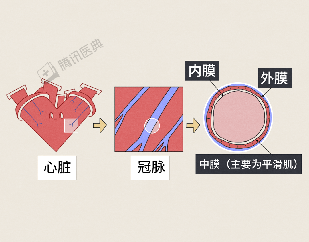 arteries翻译_arteries_arteries音标