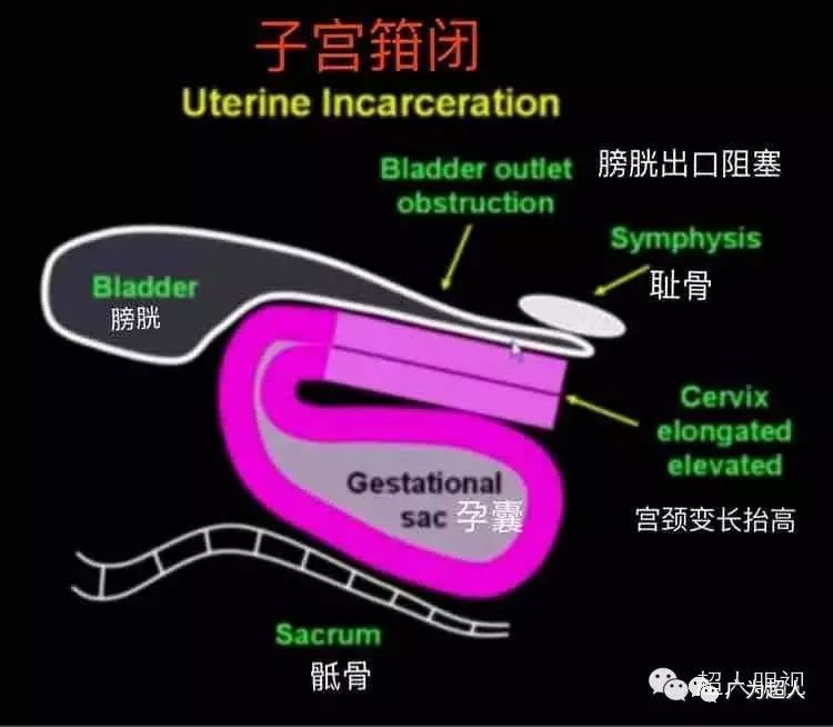 箝_箝怎么读_箝什么意思