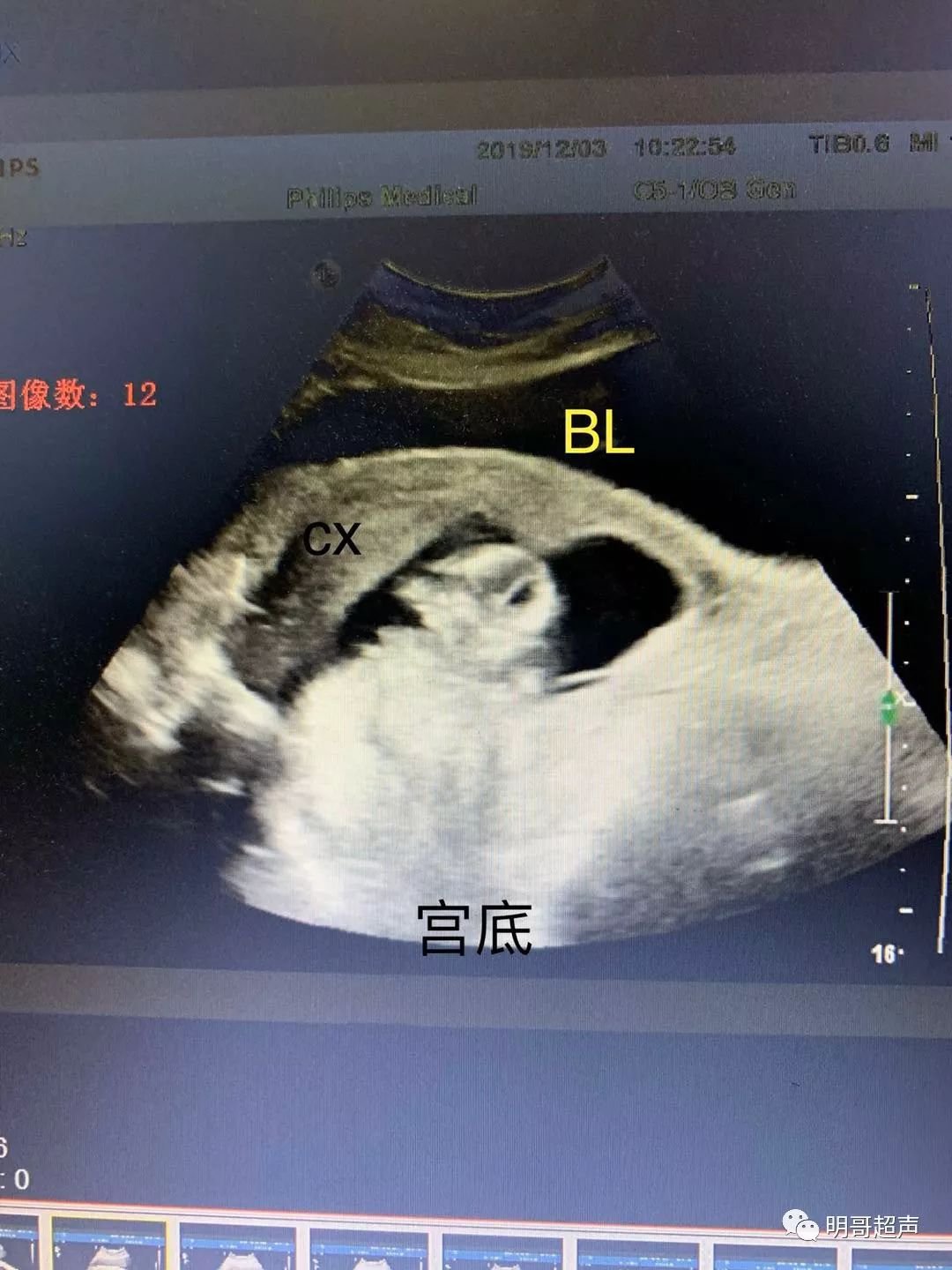 箝_箝怎么读_箝什么意思